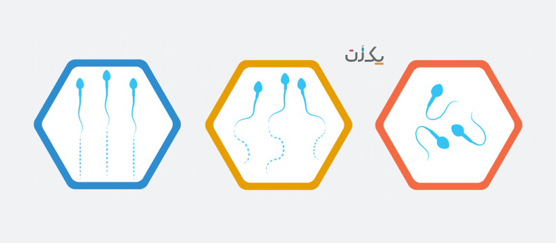 سرعت حرکت اسپرم